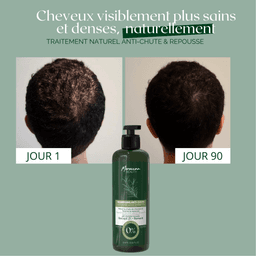 Natural Anti-Hair Loss & Regrowth Duo – 300ml Shampoo & 100ml Lotion – 90-Day Treatment