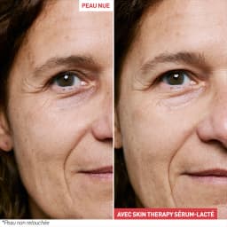 Skin Therapy Milky-Serum