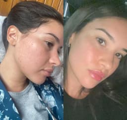 Hydra+ Routine